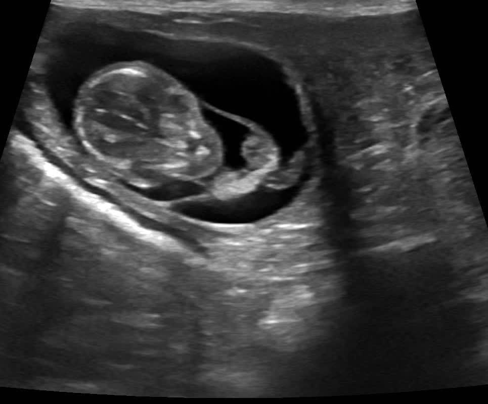 A single early-stage puppy curled up in its amniotic sac