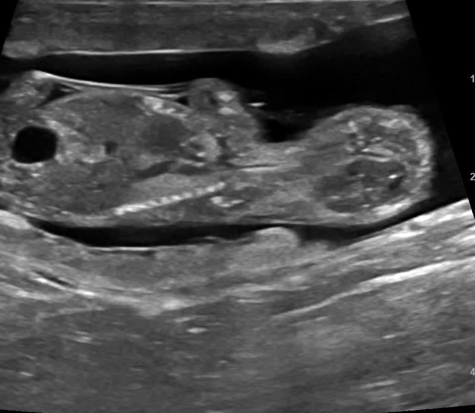 First ultrasound — a tiny puppy curled up